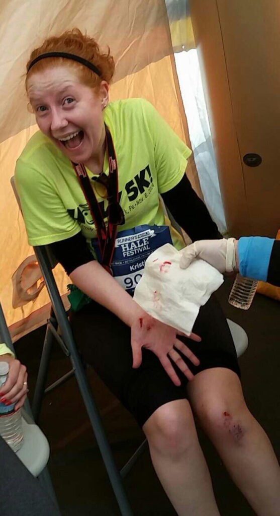 Writer and Star Wars fan Kristin Baver shows her bloody scrapes and bruises after competing in a runDisney Star Wars event.